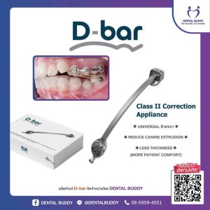 D-bar (แบบกล่อง)