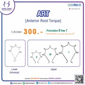 ART (Anterior Root Torque)