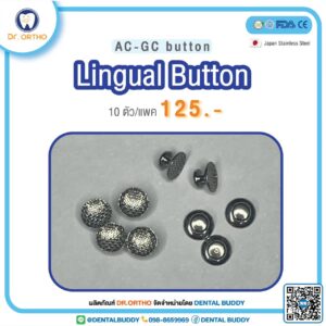 Lingual Button
